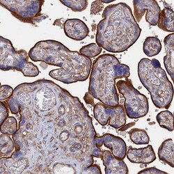 STRA6 Antibody, Novus Biologicals 25 &mu;L | Buy Online | Novus Biologicals | Fisher Scientific